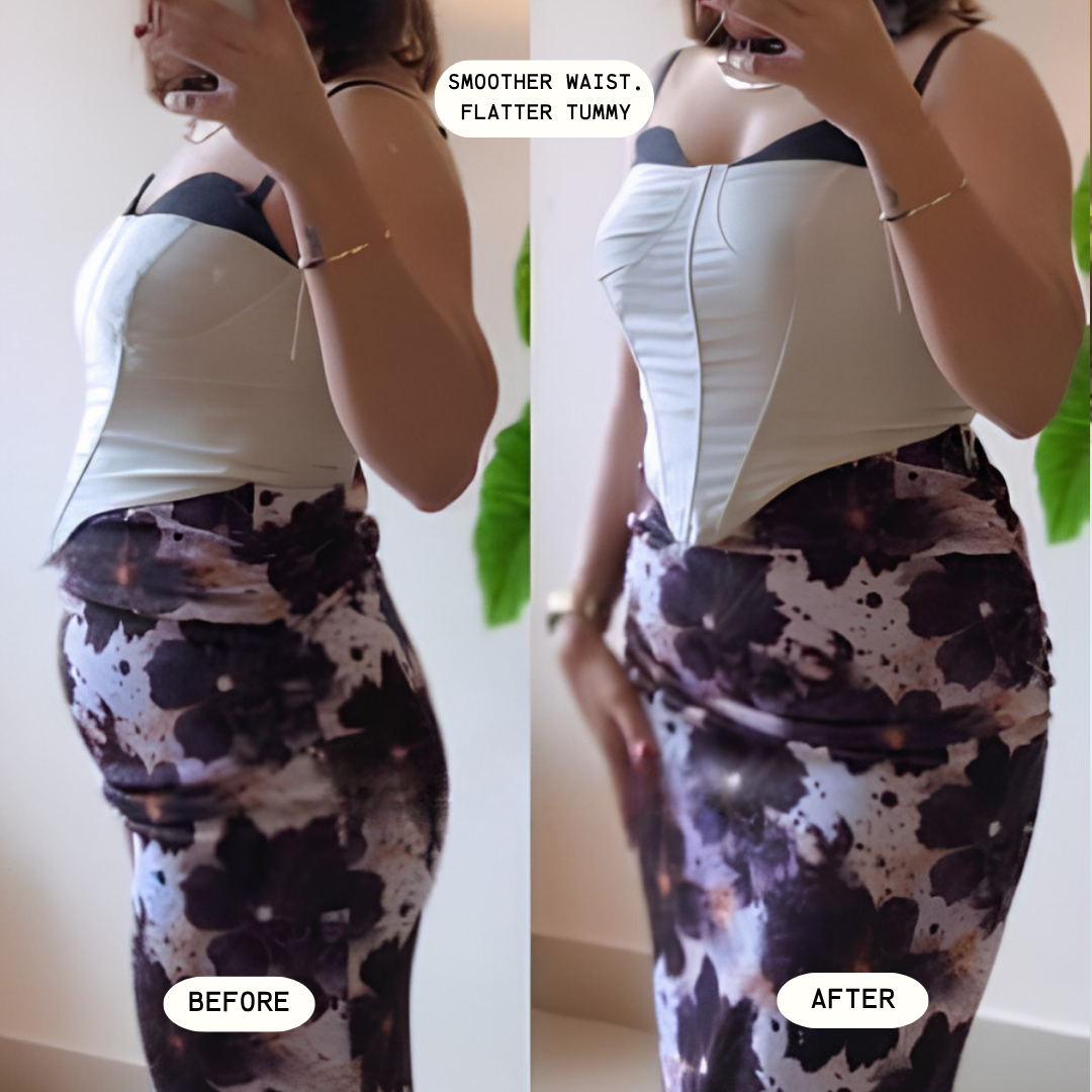 Medcurve SculptFit | Best for post partum